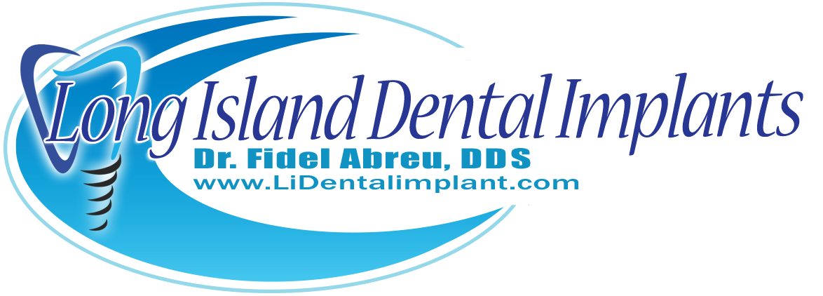 Implantes dentales de Long Island